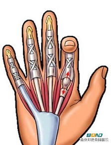 手指肌腱断裂图片 搜狗图片搜索