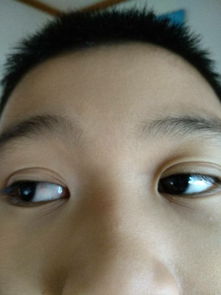 十岁孩子右眼角有些红痒,是什么病 