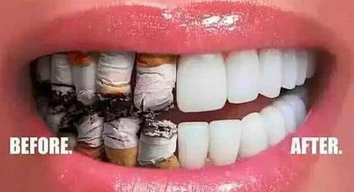 抽烟牙齿黄,怎么变白 学会5个小妙招,让你的牙齿洁白如新