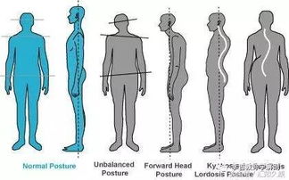 下背痛系列 八 所谓姿势,不是能站住就是稳定 