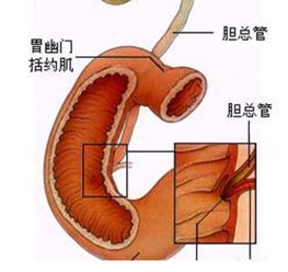 胆管癌术后多长时间可以运动 