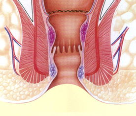 肛门刺痛是怎么回事 北京武警二院肛肠科