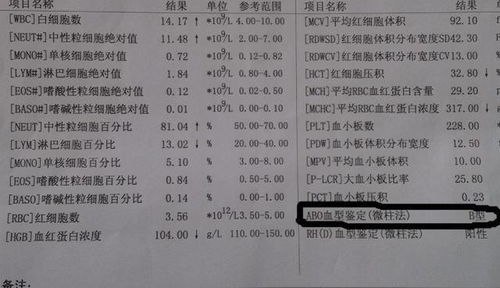 为何部分准妈妈不愿做产检 并不是因为害羞,其中原因很好理解