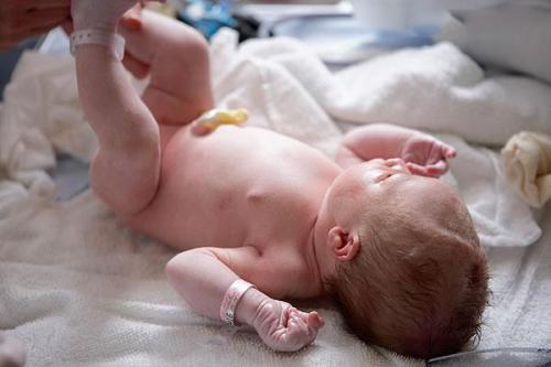 新生儿脐带的护理
