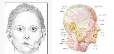 我得了面肌痉挛,除了手术还有其他办法治疗吗