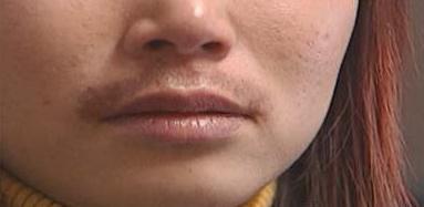 女人胡子长是什么原因 应该怎么办 去除唇毛的方法和妙招揭秘