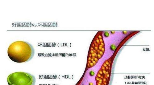 它是胆固醇的 克星 ,坚持食用,软化血管,血脂慢慢降下来