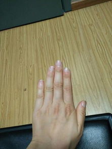 为什么有的人手指骨节很明显,有的人小而且很匀称