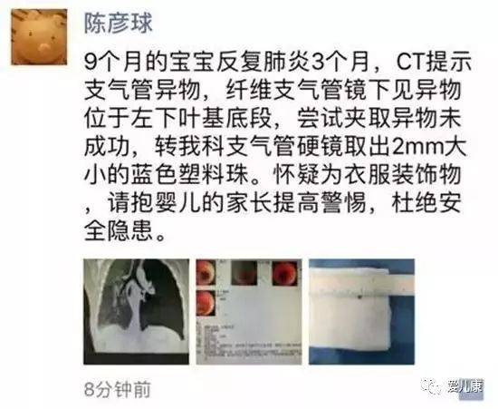 1岁女宝体内 藏 了个小猪佩奇 揭开真相后,家长吓出一身冷汗