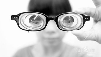 近视眼怎么恢复视力呢 