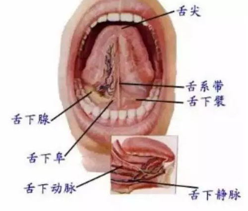 舌下取栓 