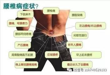 腰间盘突出必须打钉子吗还有什么其他办法(腰间盘突出必须打钉子吗还有什么其他办法可以治疗)