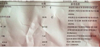 促卵泡激素偏高的原因是什么