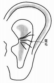 耳内生毫是什么意思,好不好 