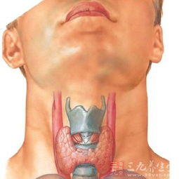 毒性弥漫性甲状腺肿的介绍 