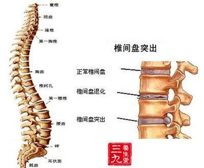 颈椎病的症状 牙疼也成为征兆 