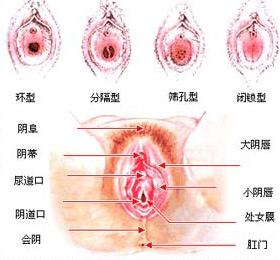 用药原则 处女膜 闭锁 经 手术 切开后一般仅需口 