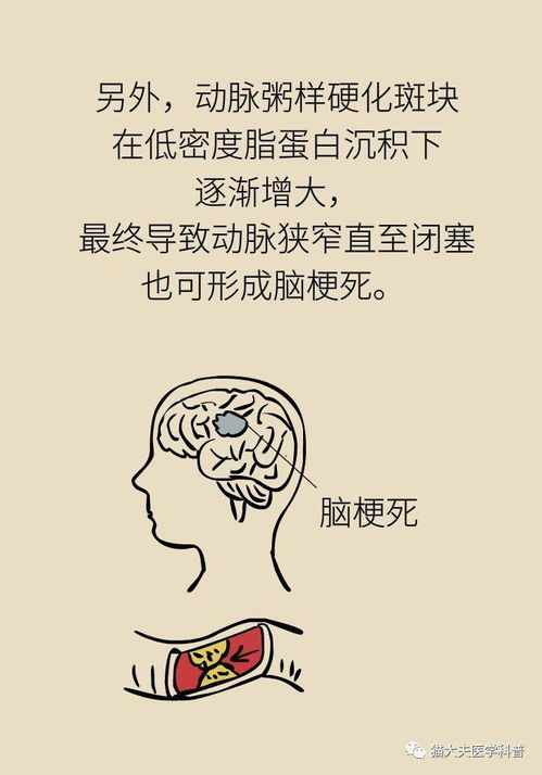 脑卒中病人有三次逆转命运的机会,抓不住就将抱撼终身