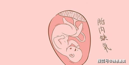 孕期,孕妈如果发现这几个 异常 ,很可能是胎宝缺氧的征兆