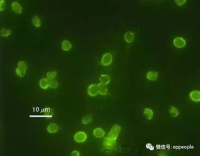 水中微生物种类图片 图片欣赏中心 急不急图文 Jpjww Com