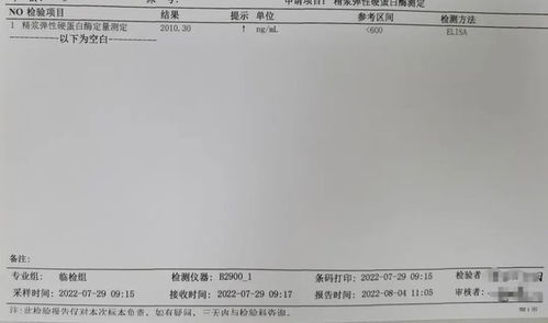 精浆弹性蛋白酶 一项需要 相机而动 的检测指标