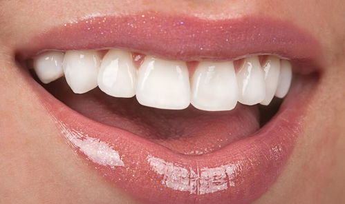 牙齿松动,是否是牙齿开始衰老 注意到以下几点,尽量避免拔牙
