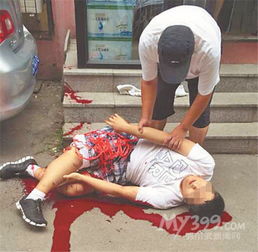 哈尔滨市男子指挥同学倒车 意外被撞伤腿