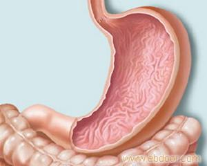 胃溃疡的症状及治疗