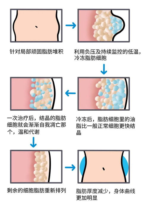 酷塑溶脂真的有用吗