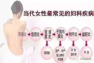 妇科癌症 目前,中国女性易发的妇科恶性肿瘤都有哪些