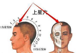 中医养生 夏季防治 空调病 ,试试按摩上星穴 