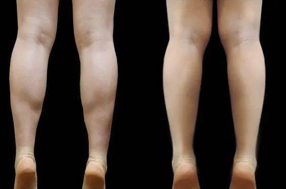 从科学角度解释 为什么男生的腿,普遍比女生细