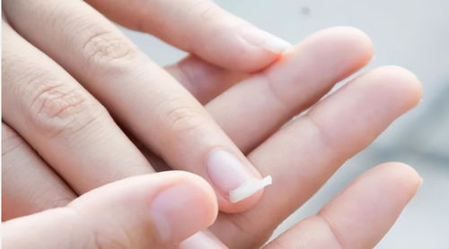 指甲半月牙消失是什么原因