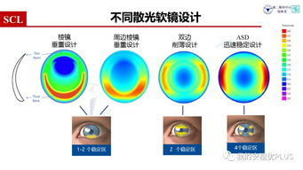 7成人群有50度以上散光 听倪海龙主任讲如何用角膜接触镜矫正散光