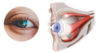 眼整形师徒对话 三 双眼皮的结构与功能 转载