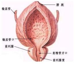 尿路感染了怎么办