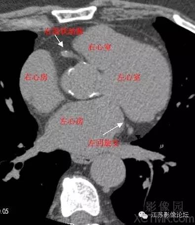 心脏全是你的ct图片 搜狗图片搜索