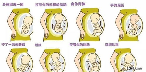 不同的孕月,胎动位置 孕妈妈感觉各不同,了解一下更好找胎心