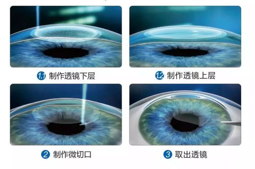 高考在即,近视眼不能报考哪些专业