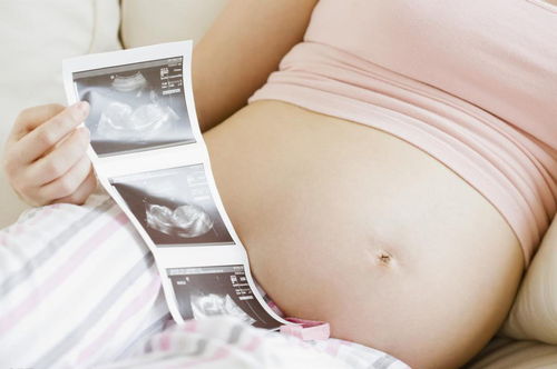 保胎药别乱吃,孕早期安胎指南送给刚怀孕的你
