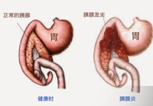 又一只网红猫突然去世,竟因为这种致命的疾病