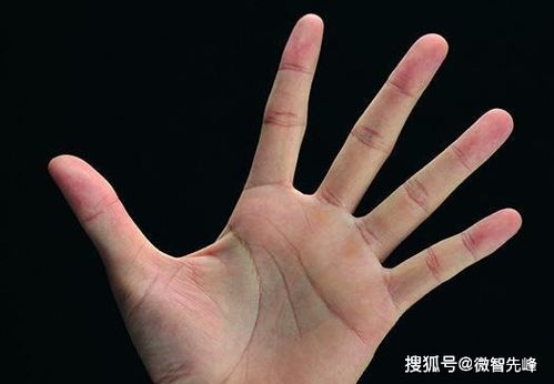 手掌纹路看身体疾病(手掌纹路与疾病图解)