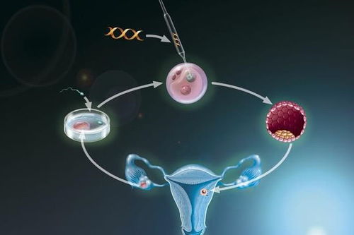 试管助孕，进行单囊胚移植会有什么好处吗？