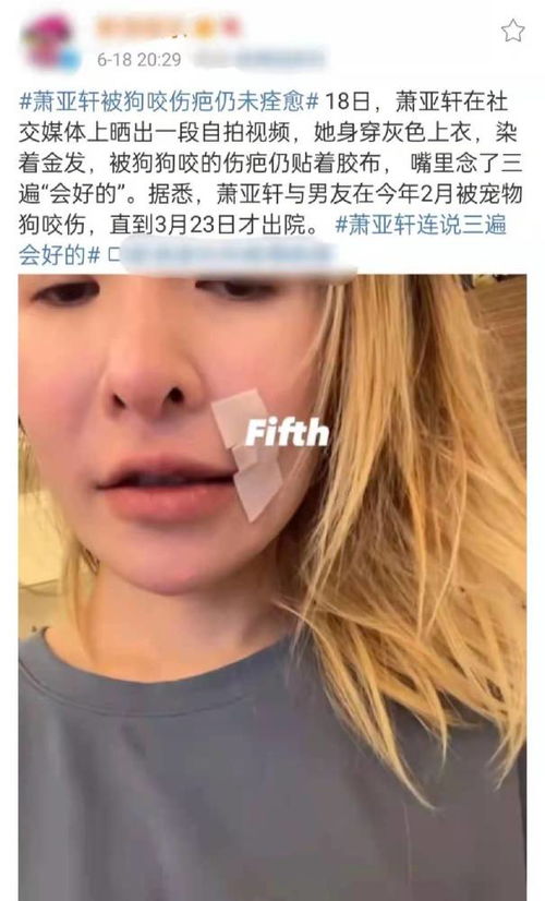 萧亚轩被狗咬伤疤仍未痊愈，视频精神状态让人担忧