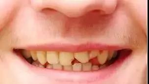 淮安牙知道 开学季,快看看孩子的牙齿怎么样了