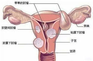 隆力奇花清丹多少钱一盒 隆力奇花清丹网上哪里有卖 隆力奇花清丹效果真有那么好 直销博客网 