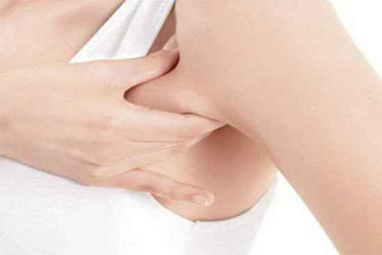 副乳 副乳对身体有什么危害