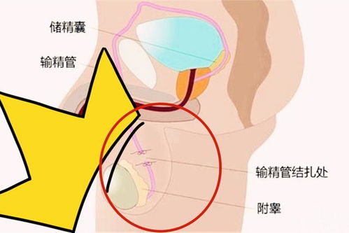 这种避孕手段安全又有效,女性可以不用受罪,敢于尝试的夫妻很少