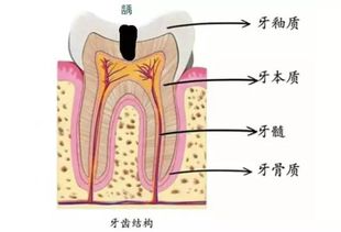 有了牙洞一定要补吗 