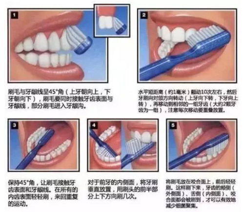 牙齿矫正正畸须知,规避18大口腔护理危害禁忌